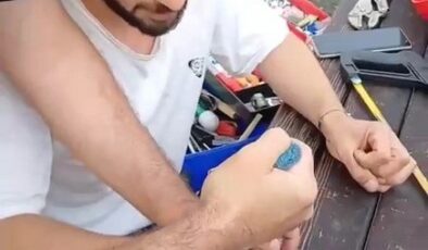 Parmağına sıkışan yüzük spiral makinesi ile kesilerek çıkarıldı