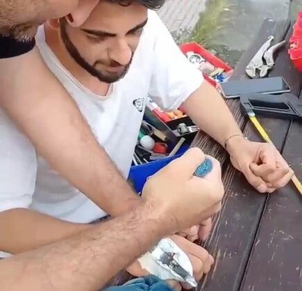 Parmağına sıkışan yüzük spiral makinesi ile kesilerek çıkarıldı