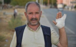 Şanlıurfa’da köpek saldırısı şoku