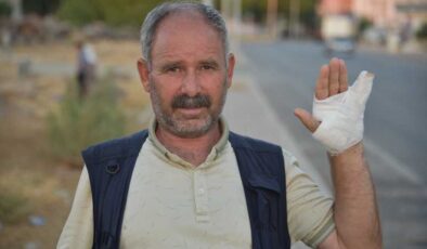 Şanlıurfa’da köpek saldırısı şoku