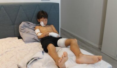 Taş attığı köpek zinciri kırarak dehşeti yaşattı