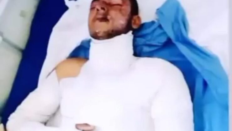 Gönül Der Derneği’nden bombalı saldırıya maruz kalan gönüllü için açıklama