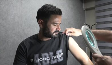 Egzama tedavisinin ardından geceleri rahat uyumaya başladı