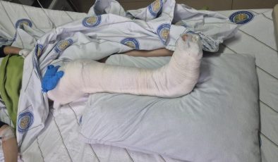 Köpek saldırısından kaçan çocuk yaralandı