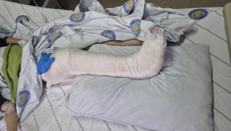 Köpek saldırısından kaçan çocuk yaralandı