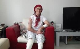 Tunceli’de köpek saldırısına uğrayan kadın ağır yaralandı