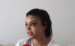 Bir kadın, düğündeki kavgada tüfekten çıkan saçmalarla gözünden yaralandı