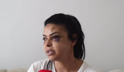Bir kadın, düğündeki kavgada tüfekten çıkan saçmalarla gözünden yaralandı