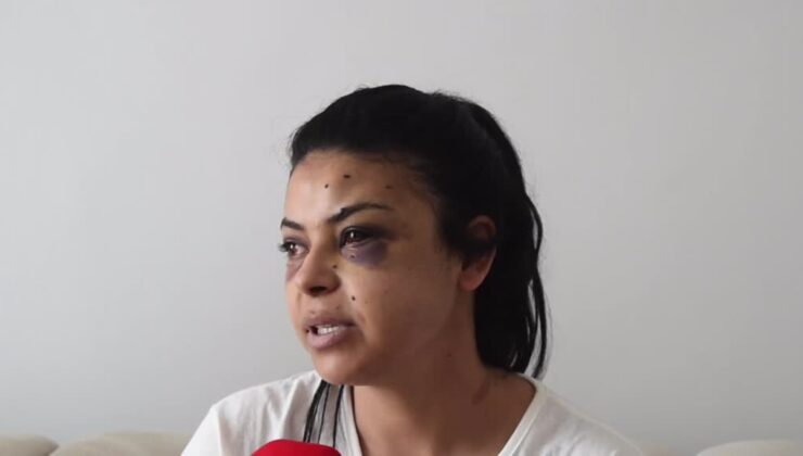 Bir kadın, düğündeki kavgada tüfekten çıkan saçmalarla gözünden yaralandı