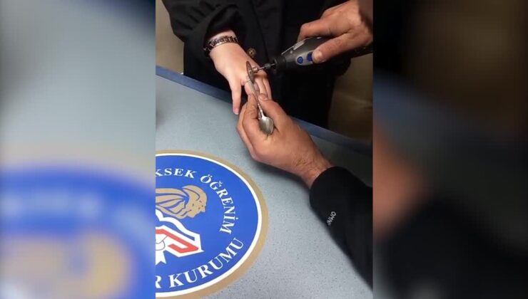 Parmağında sıkışan yüzüğü itfaiye ekipleri çıkardı