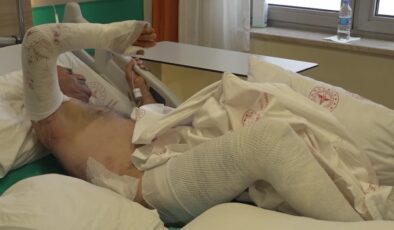 Benzin parladı, alevler içinde kaldı: Göle atlayarak kurtuldu