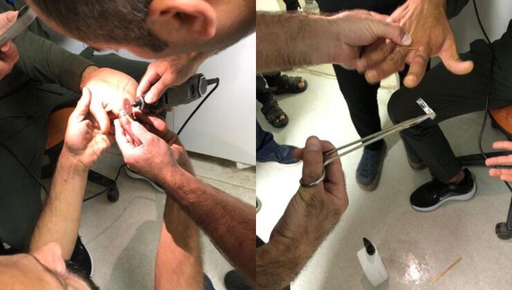Parmağına sıkışan yüzük mini aletle kesilerek çıkarıldı