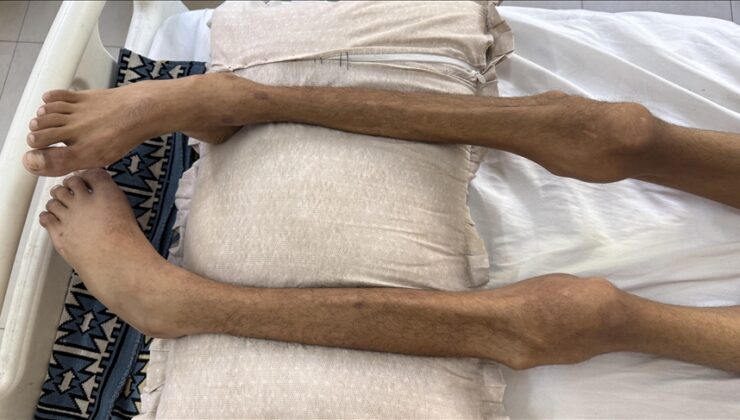 Gazze’de son 24 saatte 2 kişi daha açlıktan hayatını kaybetti
